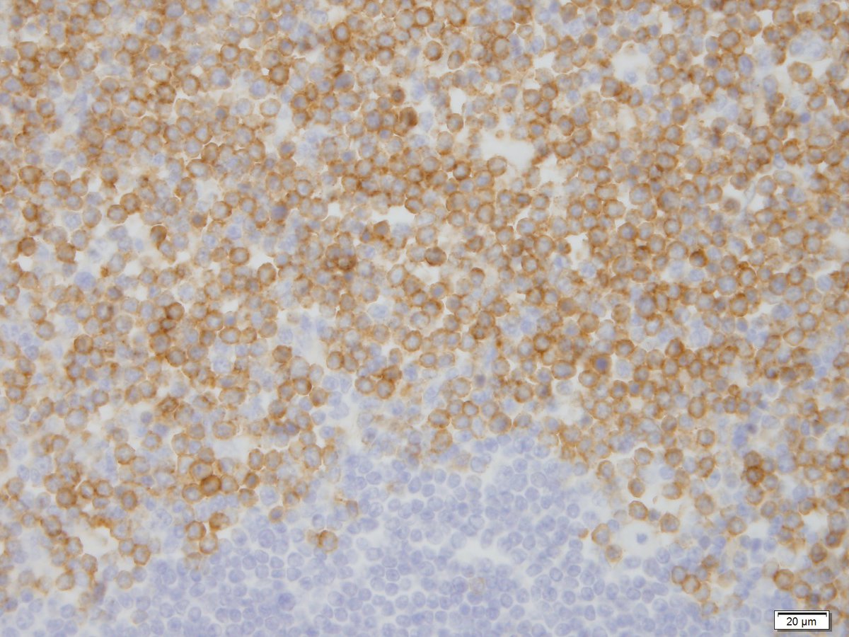 Figure 18 CD123